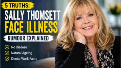 Sally Thomsett Face Illness